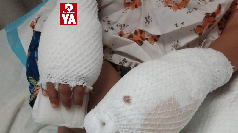 Aplazan nuevamente audiencia de medida de coerción contra madre acusada de quemar manos de su hijo - Imagen